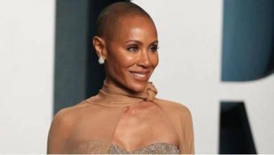 Alopecia: Celebrities Speak Openly About Their Hair Loss Struggles