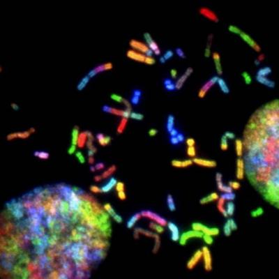 Title: New Study Links Gene Set to Human Longevity