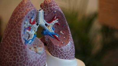 Scientifically: Discover the Leading Cause of "Killer" Cancer