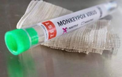 Lebanon in the Crosshairs of Monkeypox: No Testing Supplies for Two Weeks
