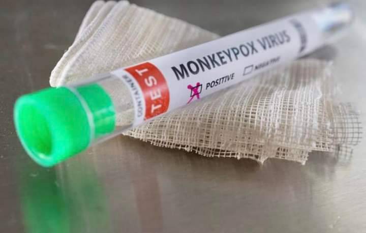 Lebanon in the Crosshairs of Monkeypox: No Testing Supplies for Two Weeks