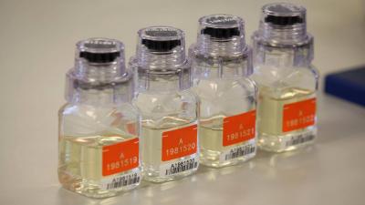 Is There a Relationship Between Urine Color and Your Health?