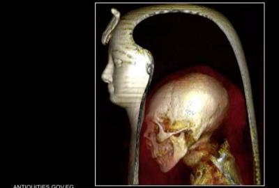 Mummy of Amenhotep I Unveils Secrets After 3000 Years