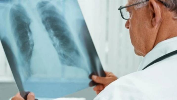 Mysterious Severe Pneumonia Baffles Doctors