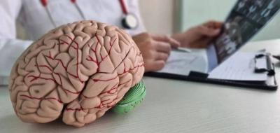 ما العلاقة بين التهاب الحلق والسكتة الدماغية؟
