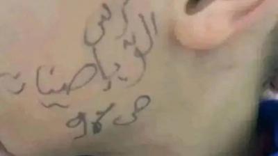 الجزائر.. أستاذة ترسم على وجه تلميذ تفجّر مواقع التواصل