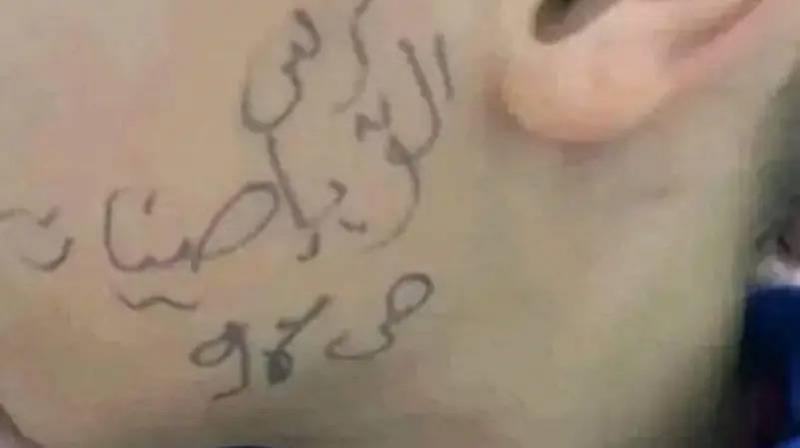 الجزائر.. أستاذة ترسم على وجه تلميذ تفجّر مواقع التواصل