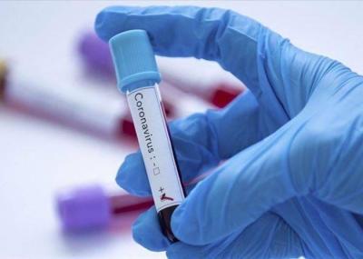 Health: 94 Covid Cases Yesterday and One Death