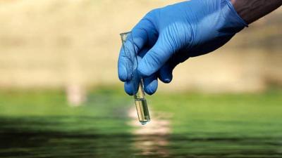 Important Announcement: Monitoring the Start of Cholera Outbreak in This Area