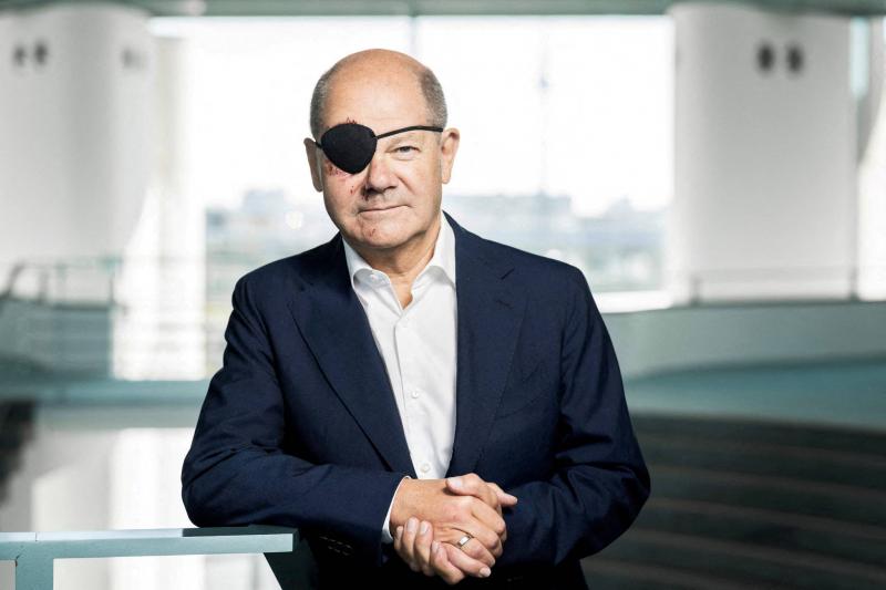 Scholz Shares Shocking Image of His Face