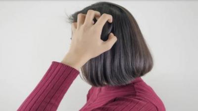 5 Reasons for Dandruff Buildup on the Scalp in Winter