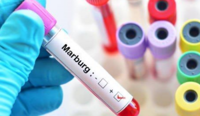 Death Toll from "Marburg" in Guinea Rises to 10