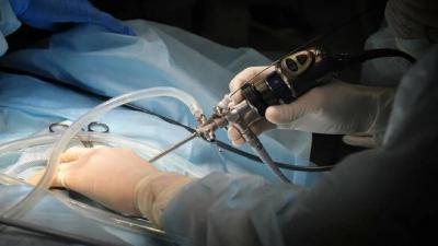 Japanese Develop Endoscope for Examining Blood Vessels and Nerves