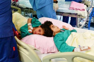 Saudi Arabia Successfully Separates Egyptian Twins "Salma and Sara"