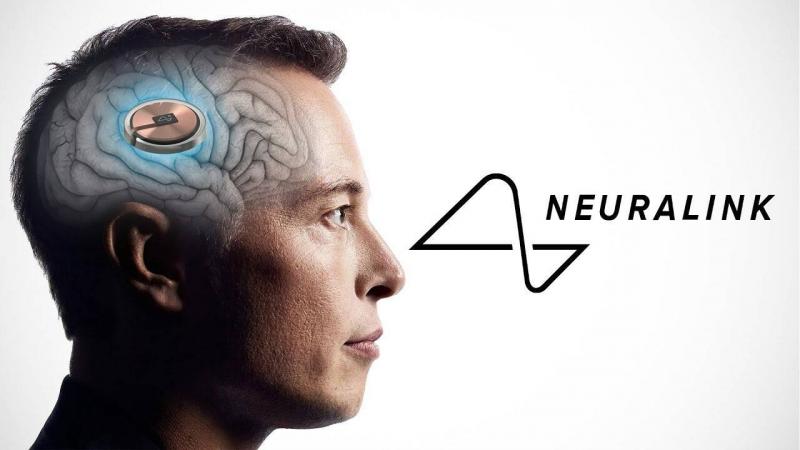 Elon Musk: Implanting Technology in Brains