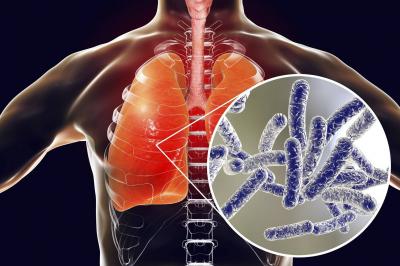 WHO Warns of Legionnaires' Disease: Where is it Spreading?