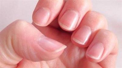 Your Nails Reflect Much About Your Health