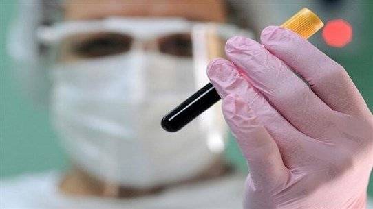 The Importance of Annual Blood Tests