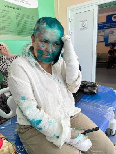 "Brutal" Attack on Prominent Russian Journalist and Her Lawyer