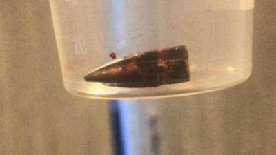 Stray Bullets Hit Lebanese University... Young Man Injured