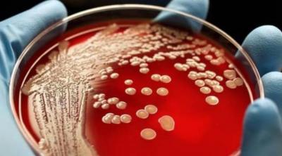Mysterious Bacteria Claims Child's Life