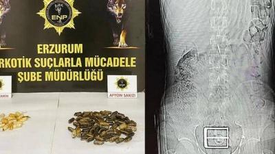 Turkish Authorities Catch Drug Smuggler with 95 Capsules in Stomach
