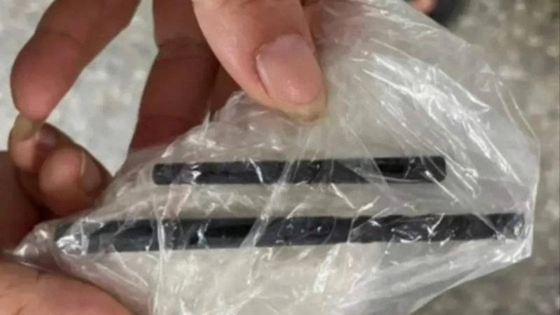 Chopsticks Pierced Patient's Skull and Remained for 5 Months