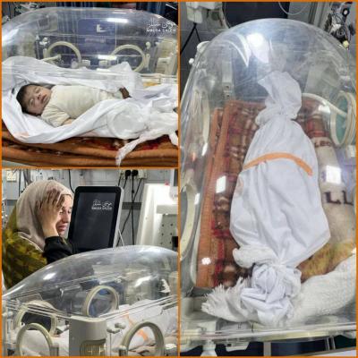 Death of 4 Children and 7 in Critical Condition Due to Drought in Gaza