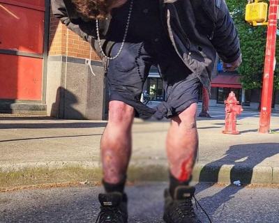 Video: "Zombie Drug" Sweeping American Streets Causes Panic