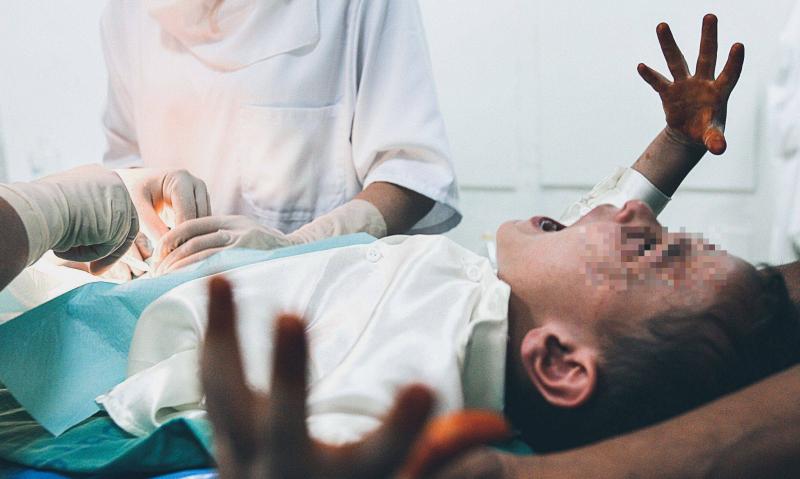 Morocco: Traditional Circumcision Procedure Results in Child's Death