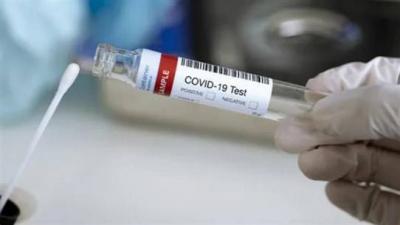 Longest COVID-19 Infection Duration in the World: Recovered After 411 Days!