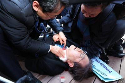 Opposition Leader in South Korea in Intensive Care After Stabbing Incident Amid Calls for Increased Security