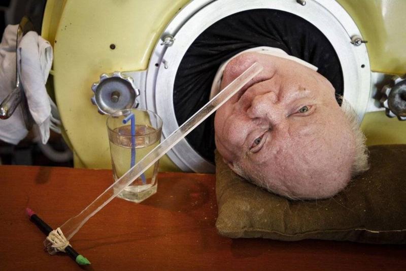Death of an American Who Lived 70 Years Inside a Iron Lung