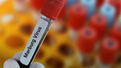 Title: Spain Reports First Suspected Case of Deadly "Marburg" Virus