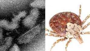 Japan Reports First Death from "Oz" Virus