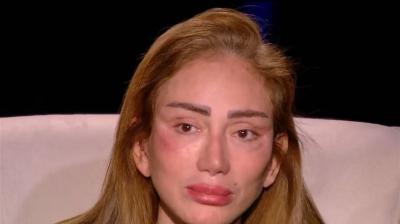 Riham Saeed Accuses Cosmetic Surgeon of Assault