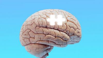 Study Reveals Link Between Alzheimer's Disease in Women and X Chromosome