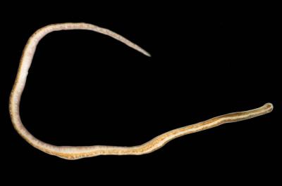 Discovery of Parasitic Worm Inside Woman's Brain Marks First of its Kind Worldwide