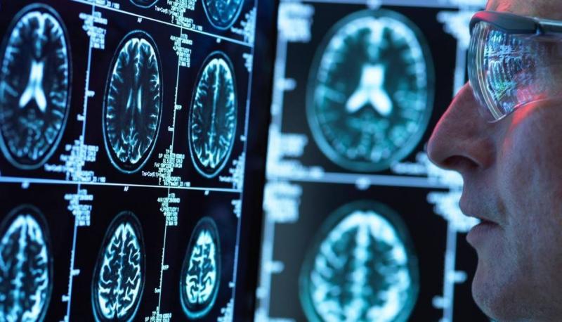 3 Things to Avoid Alzheimer’s Disease