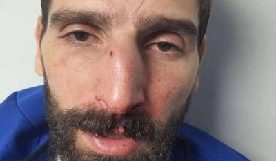 Clashes, Assaults, and Player Injuries: What Happened in Antelias Yesterday?