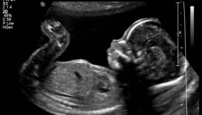 "Strange Incident": Incomplete Fetus Found in a Child's Skull!
