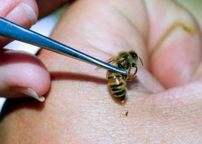 Inadvertent Ingestion of Insects: How It Affects Health