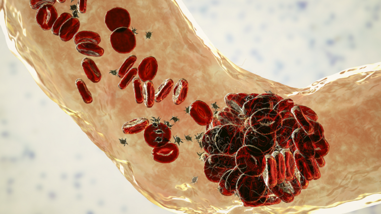 Non-Alcoholic Beverages That Can Increase Blood Clotting Risk in Just One Hour
