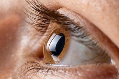 Cataracts: What Are the Causes?
