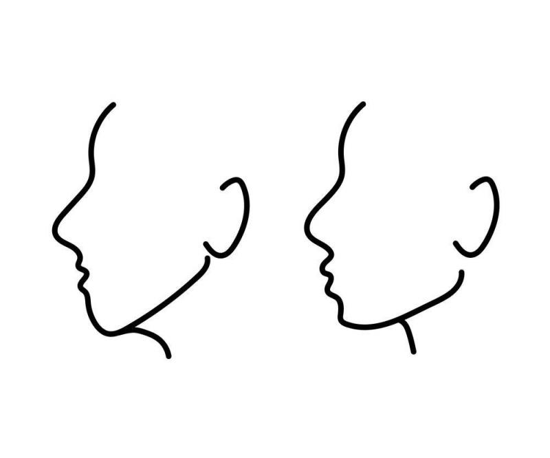 Study Reveals Facial Features Distinguishing the Rich from the Poor