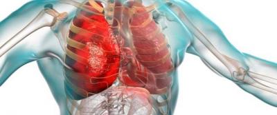 To Prevent Lung Infections... Focus on This Nutrient