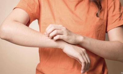 Skin Itching and Aging: 4 Medical Tips to Avoid the Worst
