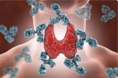 Unexpected Impact of Birth Month on Autoimmune Diseases