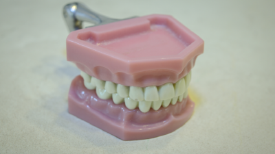 New Study Warns of Dangers of Neglecting Dentures and Their Impact on the Lungs