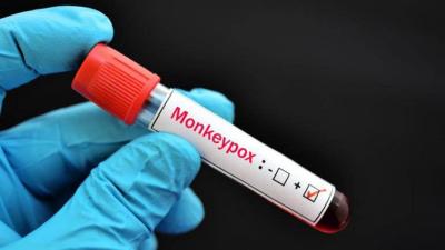 WHO Warns of Dangerous Strain of Monkeypox